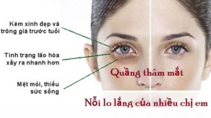 Cách trị quầng mắt thâm mắt hiệu quả